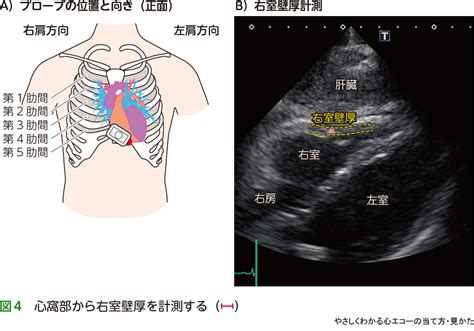 心エコー結果の見方 .